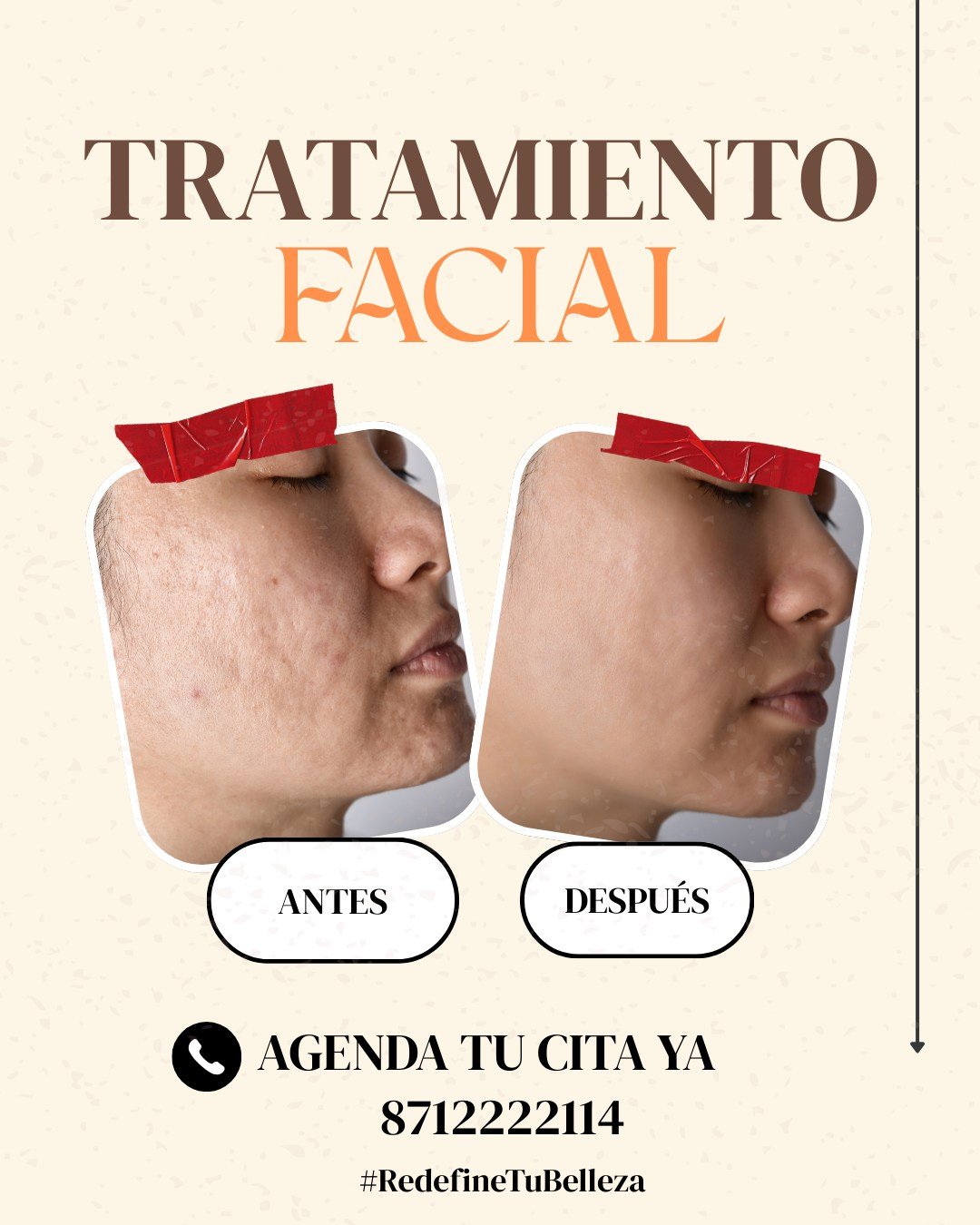 Promocional facial SPA